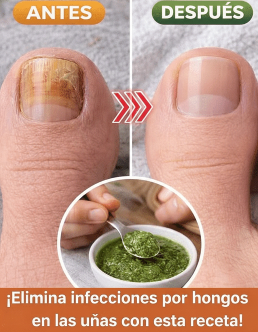 ¡Uñas y Pies Radiantes! Descubre un Remedio Casero Natural y Sencillo para su Cuidado