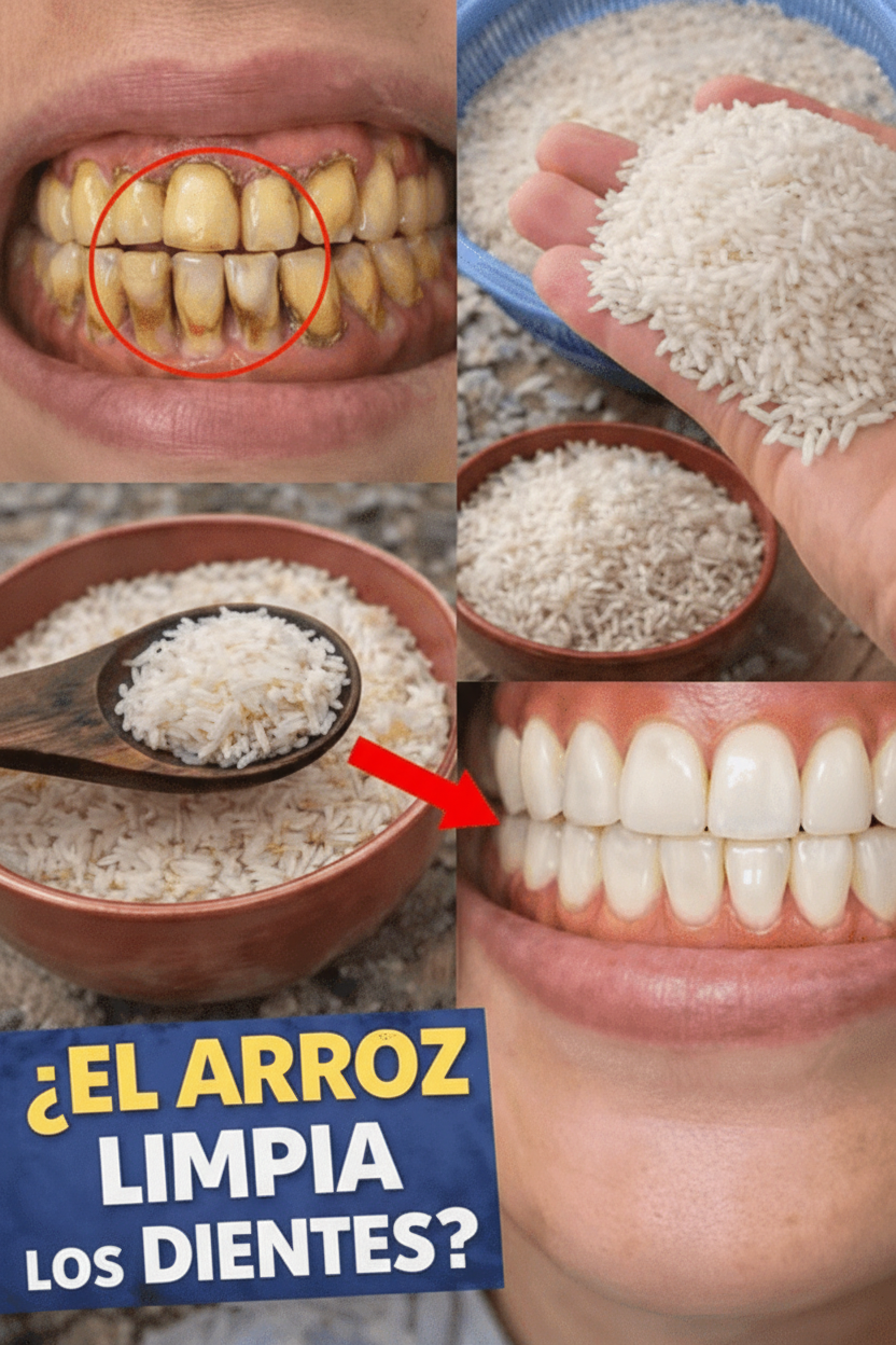¿Dientes Blancos al Instante? Desvelando la Verdad del Viral "Método Rice" y sus Riesgos para tu Salud Bucal