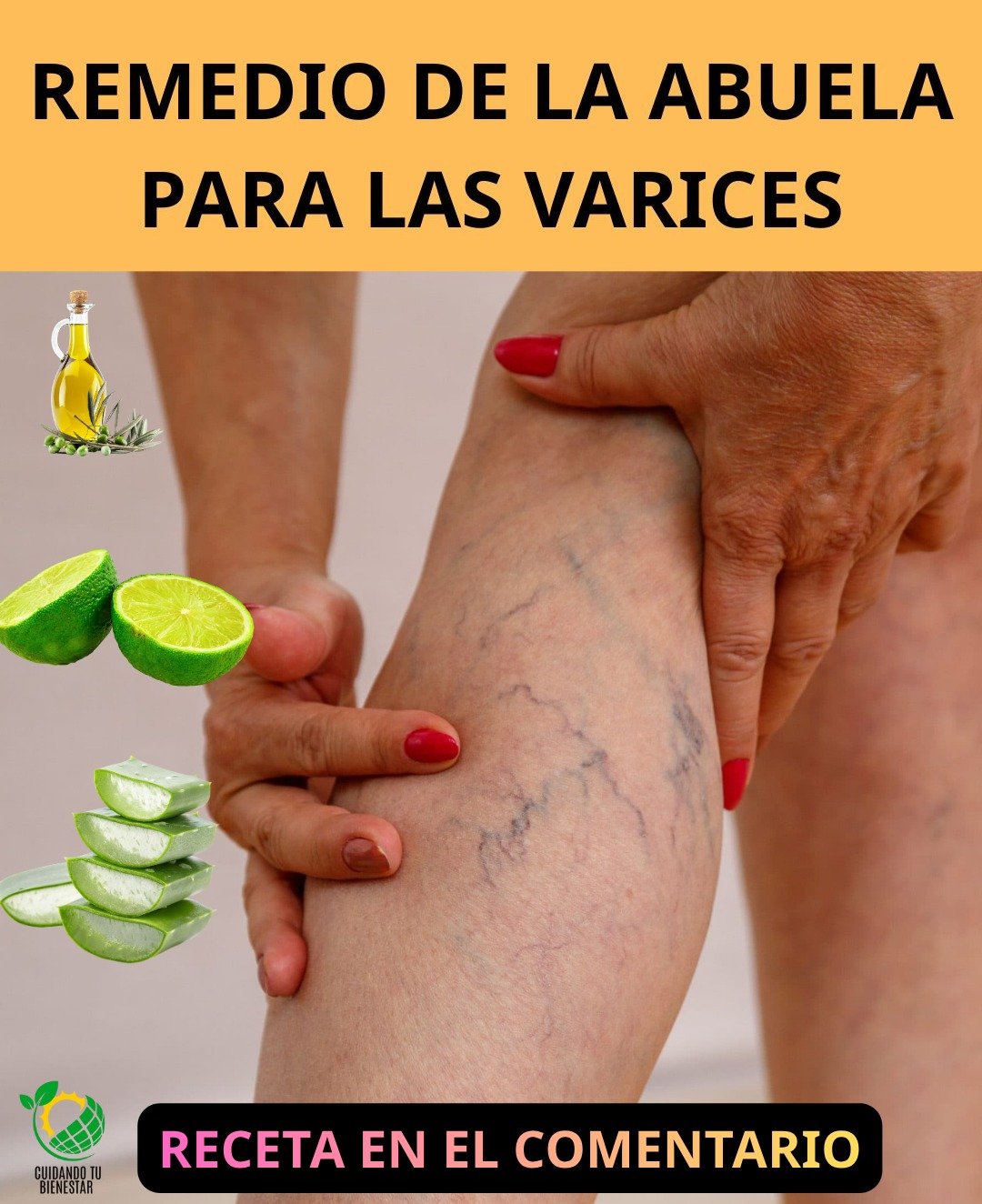 Remedio Casero para Várices: La Receta Natural de la Abuela con Aloe Vera, Vinagre y Limón