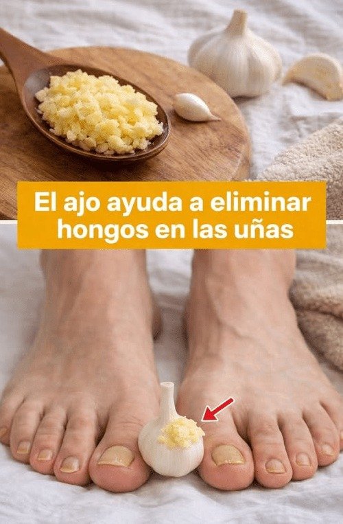 El Secreto del Ajo en tus Uñas: ¡Lo que NADIE te cuenta y necesitas saber ANTES de probarlo!