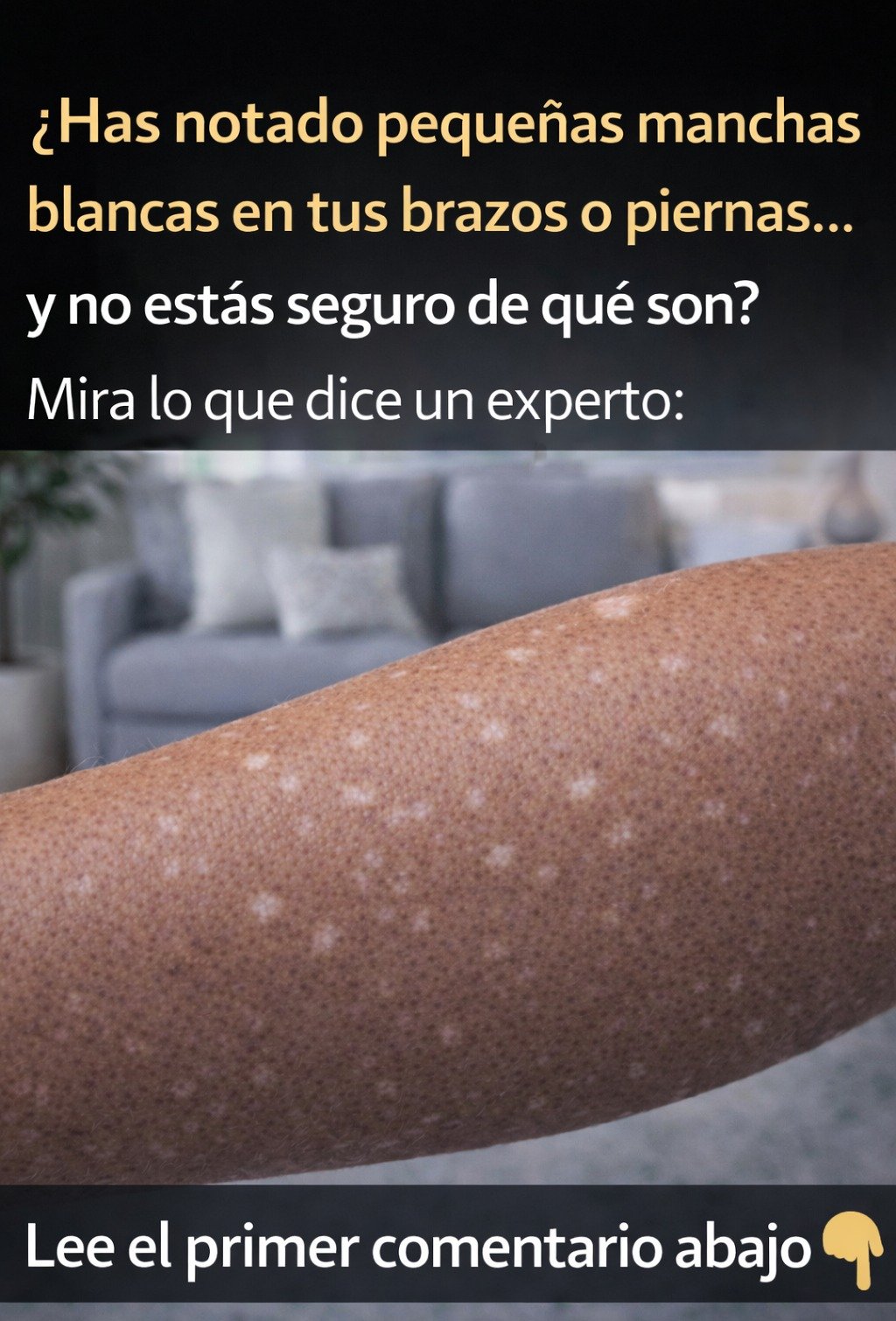 ¡NO TE LO PIERDAS! 🤫 Manchas Blancas en la Piel: Las 5 Causas Secretas y CUÁNDO ES UNA EMERGENCIA (Tu salud te lo agradecerá)