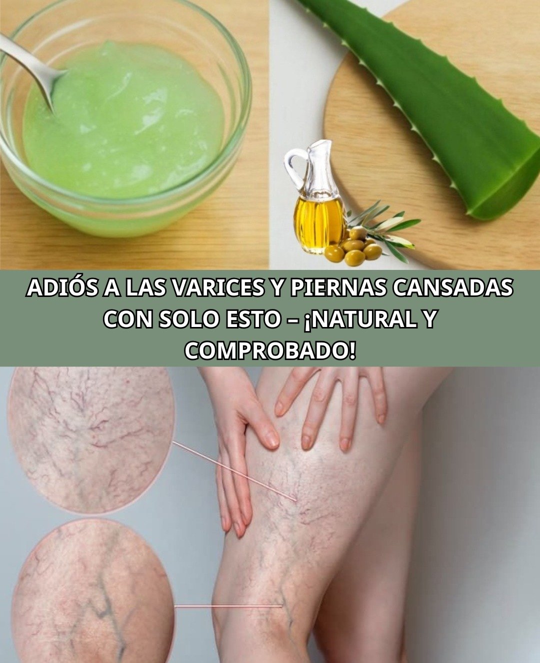 Aloe Vera: Un Remedio Natural para Várices y Piernas Cansadas