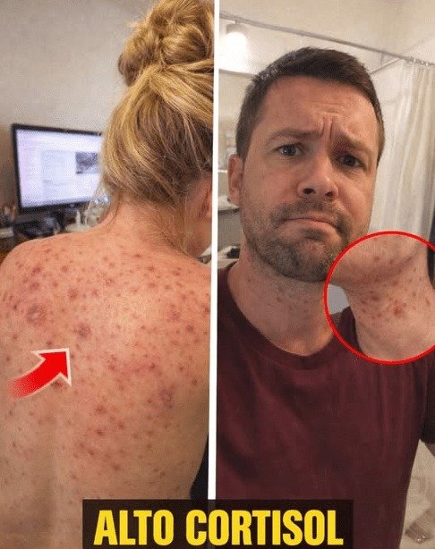 ¡Alerta! Tu cuerpo te está gritando: 5 señales CLAVE de cortisol alto que NUNCA debes ignorar