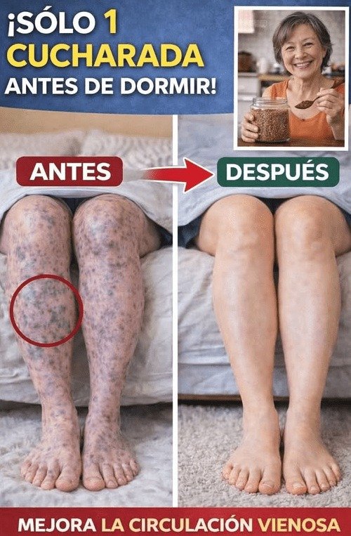 ¡Alerta! ¿Piernas Hinchadas y Pesadas por la Noche? El Truco VIRAL de 1 Cucharada Que Nadie Te Contó (y el error fatal que debes evitar)