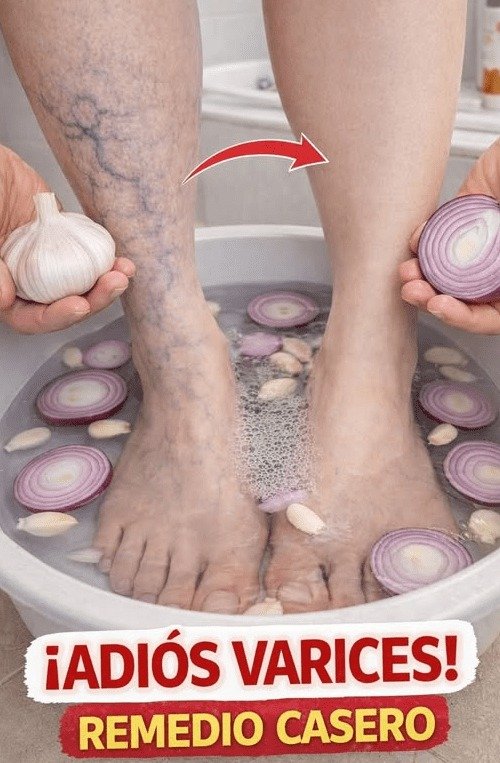 ¡Adiós Várices! El Hábito Diario SECRETO que NADIE te Cuenta para Piernas Espectaculares (y por qué lo has ignorado hasta ahora)