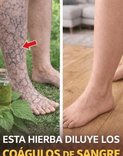 ¡Alerta! Si Tus Piernas Están Hinchadas y Pesadas, ESTO es lo que NADIE te Ha Contado (y Necesitas Saber YA)