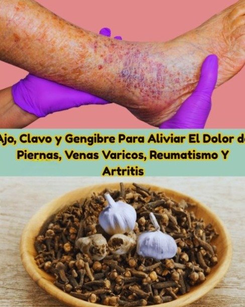 ¿Cansado del Dolor? 🤯 El Remedio de Ajo, Clavos y Jengibre que Promete Alivio a Tus Piernas y Articulaciones (¡Pero hay un SECRETO que DEBES Saber!)