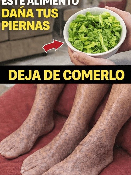¡ALERTA! Tu Comida Favorita Está Destruyendo Tus Piernas (Causa Hormigueo Y Adormecimiento) – Evítala HOY