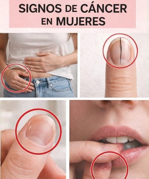 ⚠️ 14 Indicios de Cáncer Discretos que la Mayoría Pasa por Alto (y Cuándo Alarmarse)