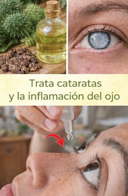 ¡ATENCIÓN! Si Tienes Ojos Secos e Irritados, ESTE Hábito Olvidado Podría SALVAR Tu Vista (y Nadie Te Lo Dice)