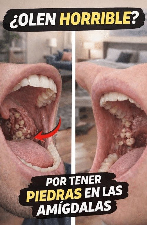 ¡ALERTA! ¿Bolitas Blancas y Mal Olor en tu Boca? La ÚNICA Solución que Nadie Te Cuenta para Eliminarlas HOY