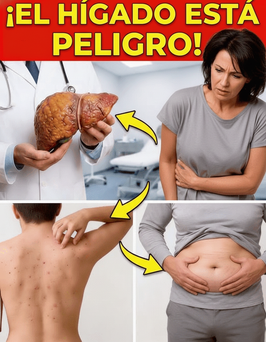 8 Señales Sutiles de Problemas Hepáticos que Muchos Ignoran: Lo que Debes Saber para tu Bienestar