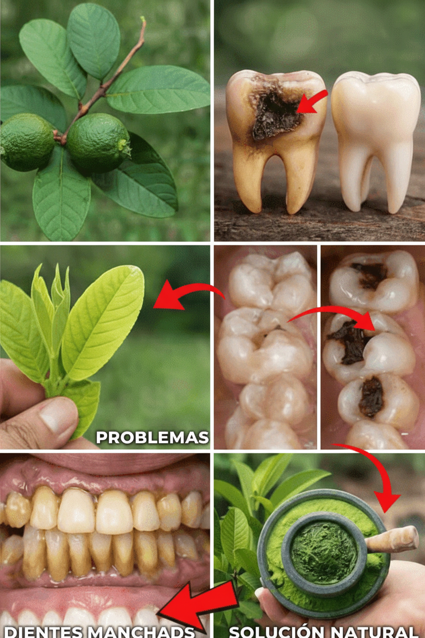 Hojas de Guayaba: 3 Remedios Caseros para Tratar las Caries Dentales de Forma Sencilla y Económica