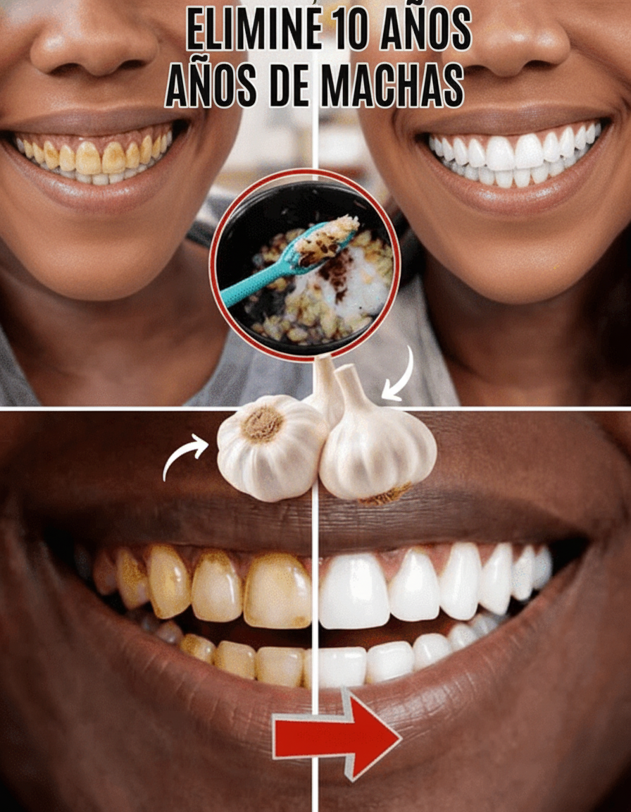 Descubre el Poder del Ajo: Un Aliado Natural para Tu Higiene Bucal y una Sonrisa Potencialmente Más Radiante