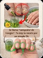 ¡ALERTA! Si Sufres de Hongos en las Uñas, ESTE Es el Secreto Natural que Necesitas Saber AHORA Mismo