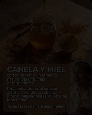 ¡Alerta! Lo que NADIE te cuenta sobre tomar miel con canela a diario (Podría cambiar tu salud PARA SIEMPRE)