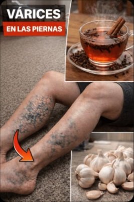 ¡Basta de Piernas Cansadas y Várices! El Hábito con Ajo y Clavo Que Nadie Te Ha Contado y Podría Transformar Tu Vida