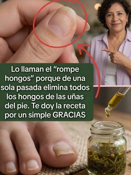 ¡Alerta Viral! El Orégano para Parásitos: ¿La Cura Milagrosa o el Mayor ENGAÑO que te Están Ocultando?