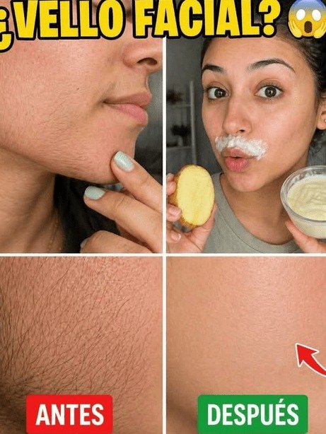 ¿Cansada del vello facial persistente? ¡Cuidado! Estás cometiendo 3 ERRORES que DAÑAN tu piel (y la solución REAL)