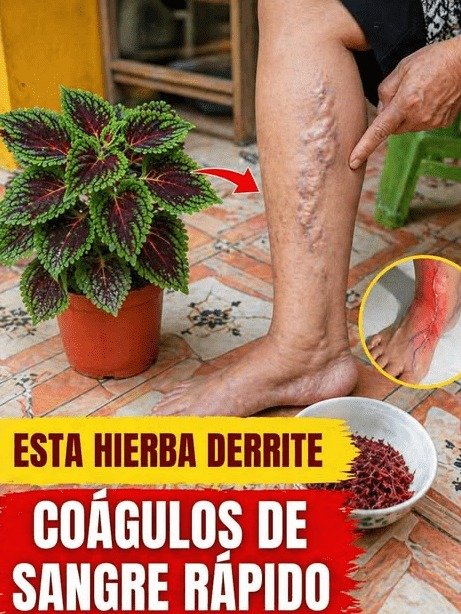 ¡ALERTA! Tus Piernas Pesadas NO son 'Cosa de la Edad': El ÚNICO Secreto que NADIE te Cuenta sobre tu Circulación (y cómo evitar un error fatal)