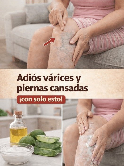 ¡No Vas a Creerlo! El Hábito Casero SECRETO que tus Piernas Cansadas y Várices te Suplicarán que Hagas Hoy Mismo