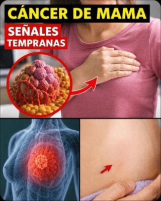 ¡ALERTA! Esta es la ÚNICA señal de CÁNCER de MAMA que casi NADIE nota (y podría salvarte la vida)
