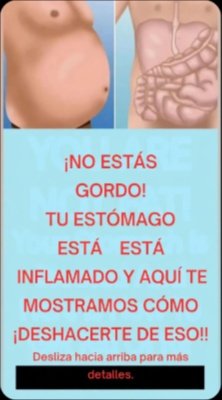 ¡ALTO! No es Grasa: El VERDADERO Motivo de tu Hinchazón y Cómo Desinflamarte en Días (Sin Dietas Locas)