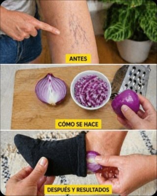 ¡No Más Várices! El Ingrediente SECRETO de tu Cocina que Transformará tus Piernas en Semanas (¡Pruébalo YA!)