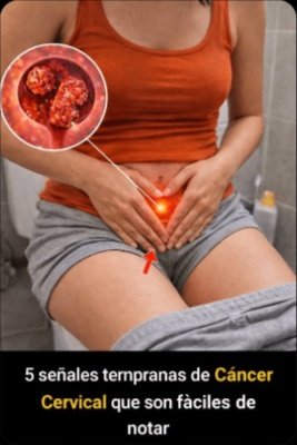 ¡URGENTE! Millones de Mujeres Ignoran Estas 5 Señales Clave que Podrían Salvarlas del Cáncer Cervical