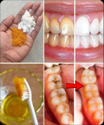 ¡Alerta! Descubre el Secreto de la Cúrcuma para Blanquear Tus Dientes (¿Funciona de Verdad?)
