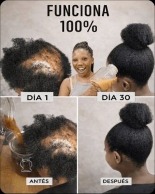 ¡SOS Capilar! Descubre el Secreto VIRAL que Revive tu Cabello Dañado en Solo 30 Días (¡No creerás los resultados!)