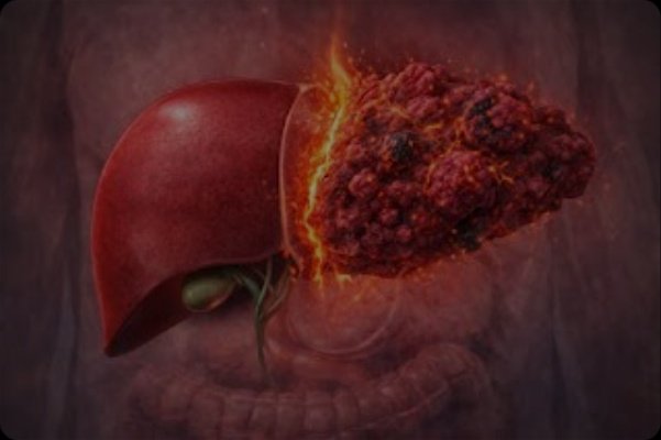 Tu Hígado Te Habla: 7 Señales de Cáncer Que NO Puedes Ignorar Ni Un Día Más (¡Podría Salvar Tu Vida!)