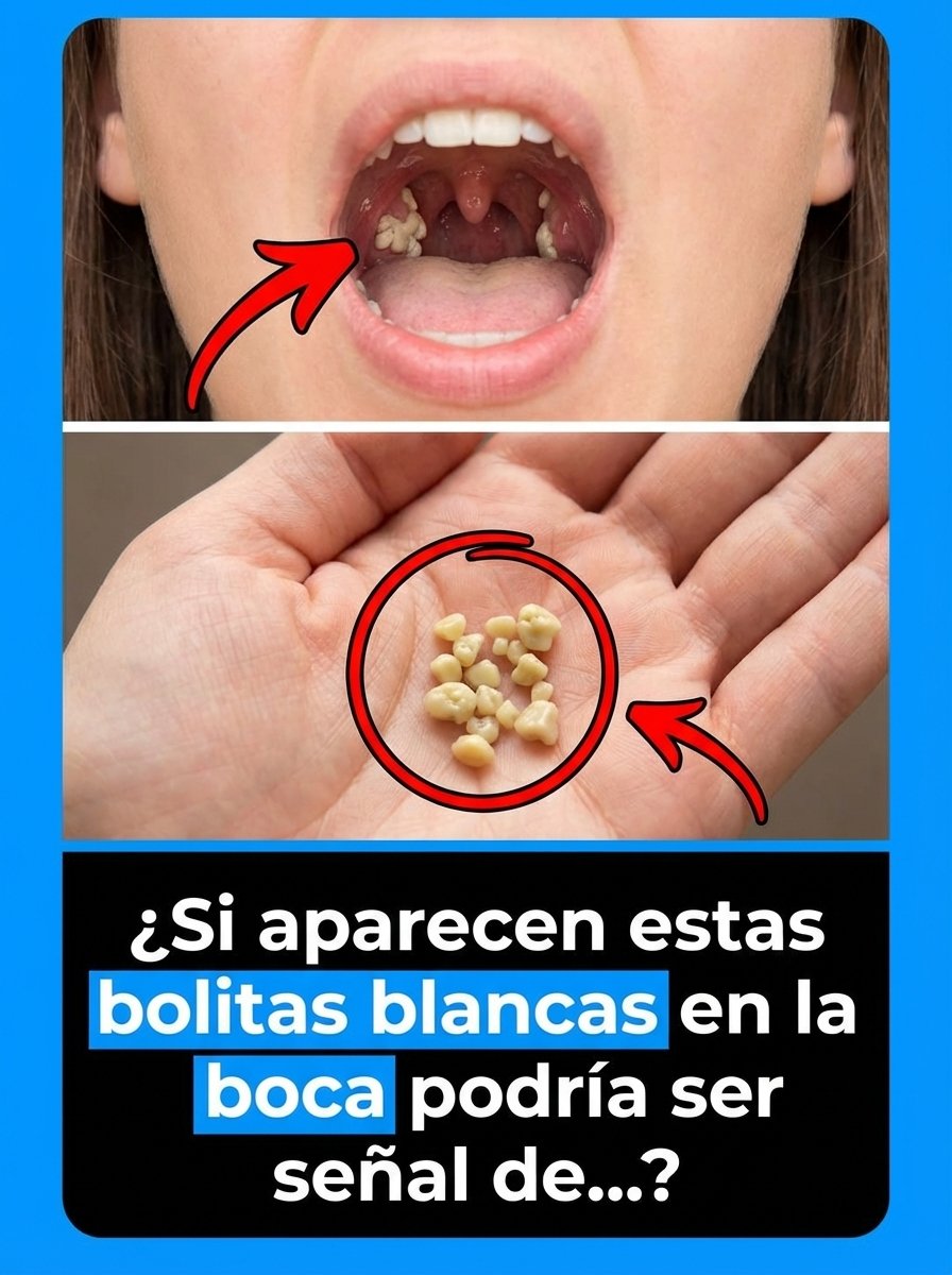 ¡Alerta en tu Boca! Si ves estas Bolitas Blancas, NO las ignores: La Verdad Oculta que Necesitas Saber URGENTE