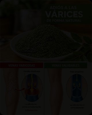 5 Hábitos Que Empeoran Tus Várices SIN Que Lo Sepas (Y El Único Que Nadie Te Dice Para Salvar Tus Piernas)