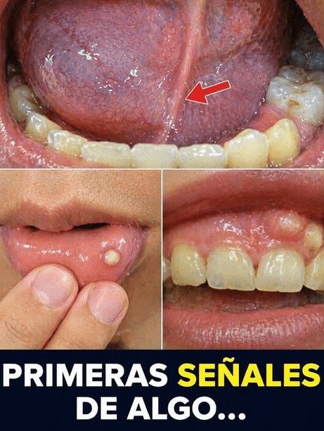 ¡ALERTA MÁXIMA! ¿Sientes ESTO en tu boca? Podría ser una señal de PELIGRO que NUNCA debes ignorar