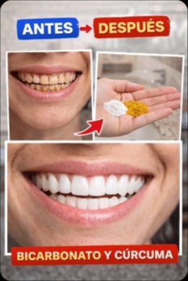 El Secreto de 2 Minutos para Unos Dientes Blancos Radiantes que los Dentistas NO Quieren que Descubras