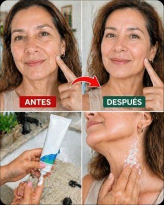 ¡No Vas a Creerlo! El Remedio Casero VIRAL Que Rejuvenece Tus Manos Y Brazos Eliminando Arrugas Y Manchas Oscuras (Resultados Garantizados)