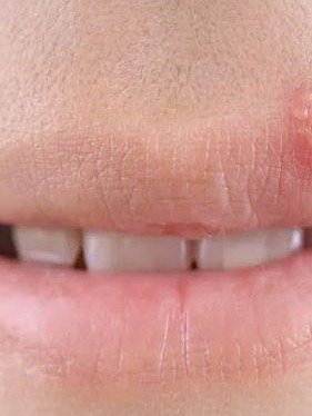 ¡ALERTA ROJA! 🚨 Si ves ESTO en tu piel, tu cuerpo te está suplicando AYUDA (y NUNCA debes ignorarlo)