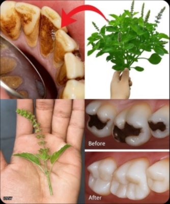 ¡El Secreto Ancestral que Tu Dentista NO quiere que Sepas! 🤫 Cómo el Tulsi REVOLUCIONARÁ tu Salud Bucal para Siempre