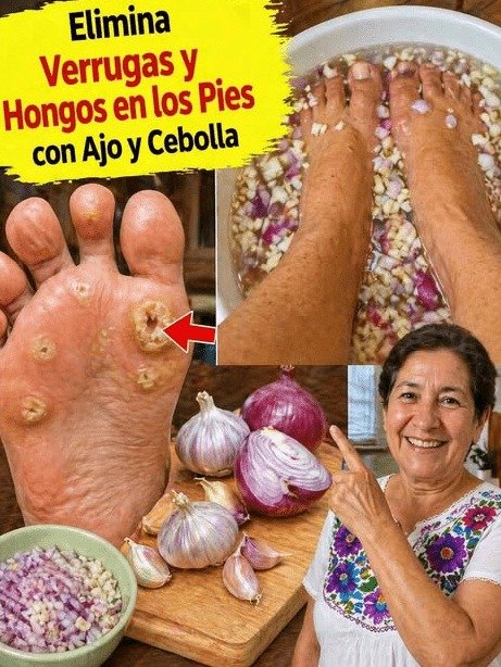 ¡ALERTA! Antes de Poner Ajo y Cebolla en tus Pies, Necesitas Saber ESTO (Podría Empeorar Todo)