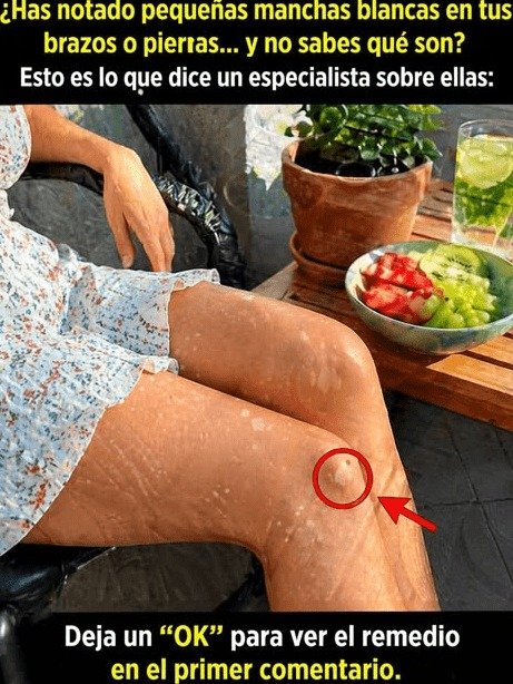 ¡Alerta Roja! ¿Manchas Blancas en tu Piel? Descubre los 5 Hábitos Secretos que las EMPEORAN (y Cómo Revertirlo HOY Mismo)