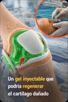 ¡ALERTA! Si tus Rodillas 'Truenan' al Levantarte, Este Avance Científico Podría Cambiar Tu Vida para Siempre