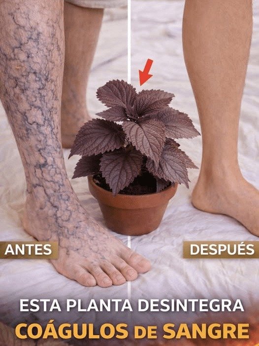 ¡Alerta Roja! ¿Piernas Pesadas y Venas Marcadas? Descubre el Secreto que Nadie Te Cuenta para una Circulación Impecable HOY Mismo
