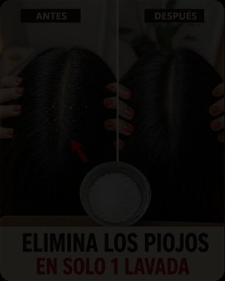 ¡ALERTA! El Engaño Viral de las Fotos de Piojos Revelado: El ÚNICO Secreto de Dermatólogos Mexicanos para Eliminarlos para Siempre (y cómo te ahorrarás CIENTOS de pesos)