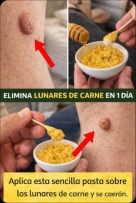 ¡Descubre el Secreto! ¿Verrugas o 'Lunares de Carne'? 5 Hábitos Caseros Seguros que Debes Conocer HOY Mismo (¡Evita Errores Comunes!)