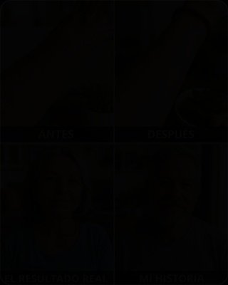 ¡ALERTA MÁXIMA! Si Usas Laurel para las Arrugas, ESTÁS COMETIENDO un ERROR que Daña Tu Piel Sin Que Lo Sepas (Y Te Hace Perder Dinero)