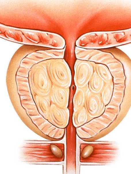 ¡Alerta! ¿Problemas de Vejiga y Próstata? Este Simple Hábito Podría Cambiarlo TODO Sin Que Te Des Cuenta