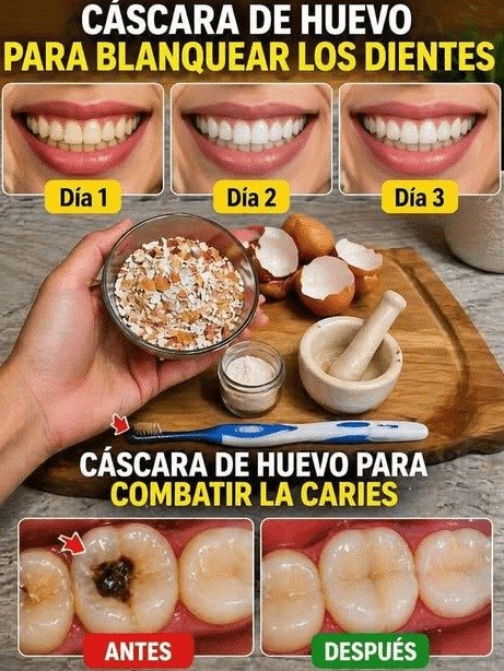 ¡ALERTA DENTAL! ¿Cáscara de Huevo para Blanquear? La VERDAD que NADIE te dice y que pone en PELIGRO tu sonrisa (¡Detente AHORA!)