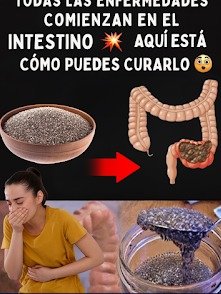 ¡Alerta de Salud! Si no Sanas TU INTESTINO, Podrías Estar Invitando 10 Enfermedades Mortales: La Guía DEFINITIVA para Transformar tu Vida