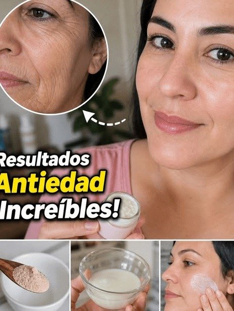 ¡Detente! Antes de Usar Yogur y Levadura para tus Arrugas: La Única Verdad que NADIE te Cuenta (y te Urge Saber HOY)